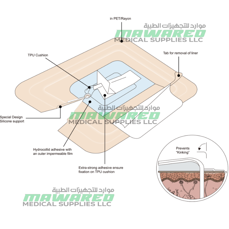 Drain-Lok Catheter Securement Device for 5Fr/6Fr/7Fr/8Fr/9Fr/10Fr/11Fr/12Fr Drainage Catheters – 25 Pcs/Box - Image 2